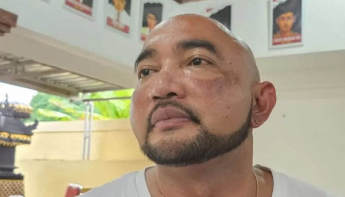 Pilkada via DPRD Dinilai Sah, Gerindra Bali Nilai Efisien dan Jaga Stabilitas Daerah